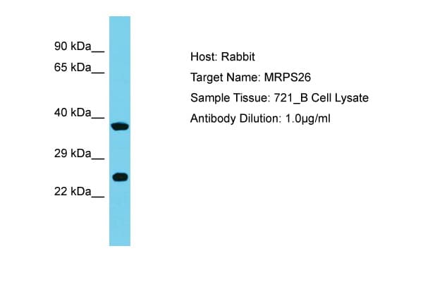 Polyclonal Rabbit anti-Human MRPS26 Antibody (aa134-183, WB)