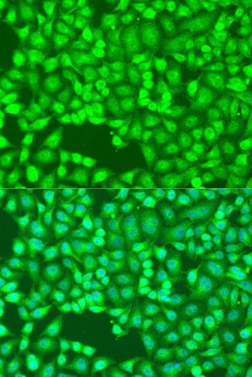 FLT4 / VEGFR3 Antibody