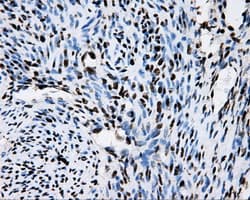 RPA2 / RFA2 / RPA34 Antibody (clone OTI9A1)