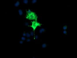 CMPK / CMPK1 Antibody (clone OTI1A9)