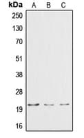 CTF1 / Cardiotrophin-1 Antibody (N-Terminus)