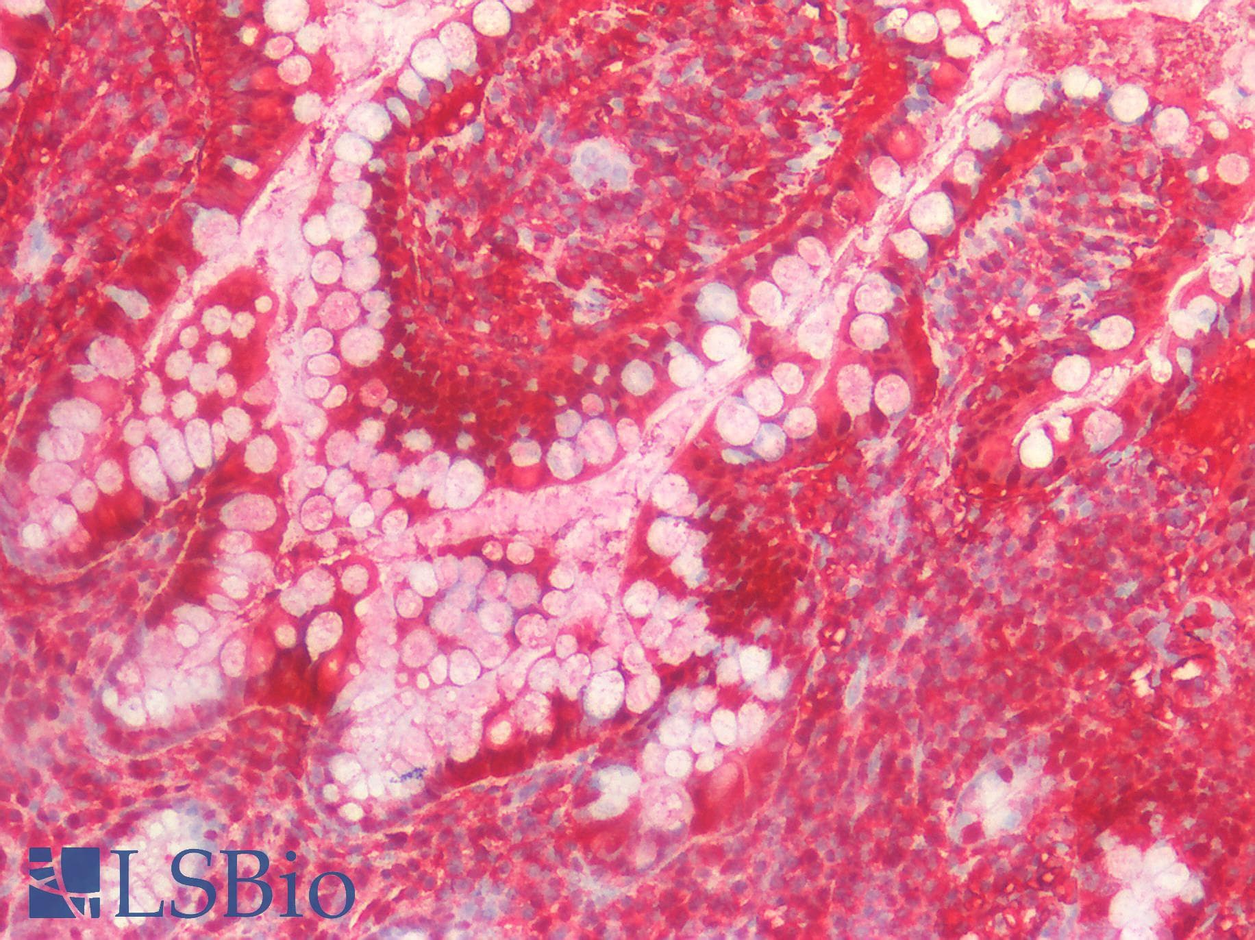 IHC-plus™ I-BABP / FABP6 Antibody