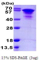 Human MAPT / Tau Protein (Recombinant His)