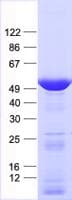Human KRT14 / CK14 / Cytokeratin 14 Protein (Recombinant His, N-Terminal)