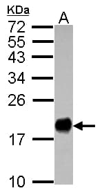 IHC-plus™ Polyclonal Rabbit anti-Human Fragilis / IFITM3 Antibody (IHC, WB)