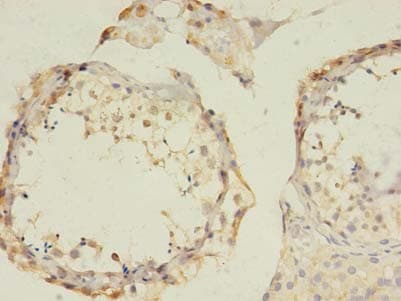 Polyclonal Rabbit anti-Human GABRB2 Antibody (IHC)