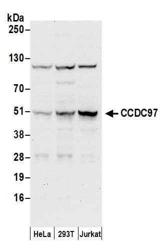 Polyclonal Rabbit anti-Human CCDC97 Antibody (aa293-343, WB)
