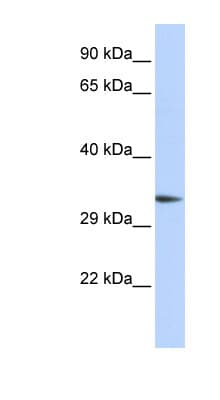 Polyclonal Rabbit anti-Human GLUP / PACRG Antibody (aa216-265, WB)