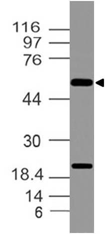 IMPDH2 Antibody