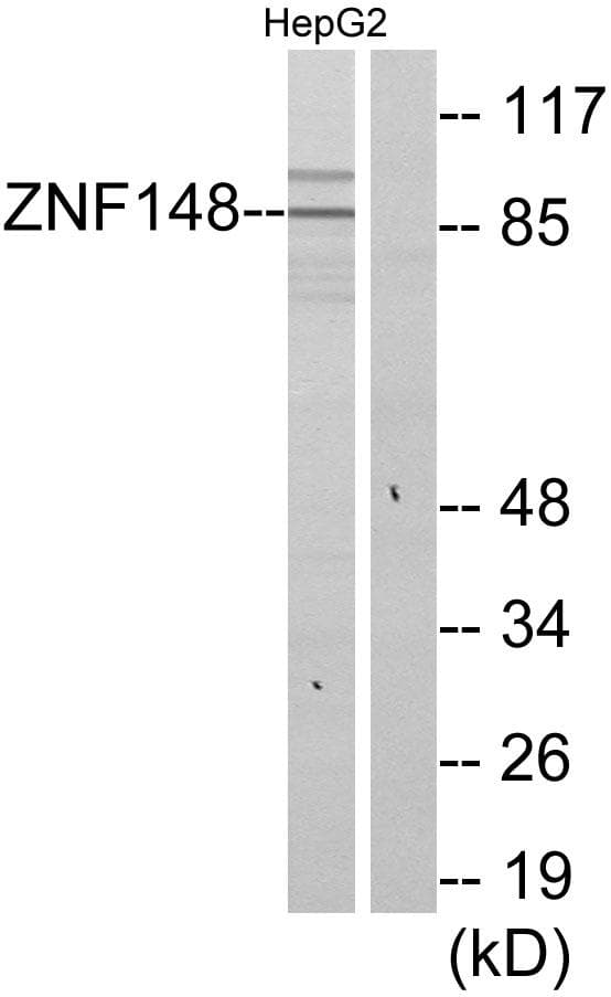 ZNF148 / ZBP-89 Antibody