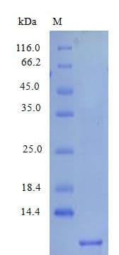 Human CXCL7 / PPBP Protein (Recombinant)