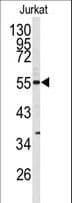 CDK8 Antibody (aa1-30)