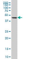 Monoclonal Mouse anti-Human FOXA1 Antibody (clone 1B1, IHC, IF, WB)