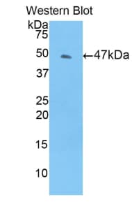 TIMP4 Antibody (aa10-170)