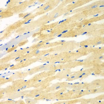 Polyclonal Rabbit anti-Human PDE4DIP / MMGL Antibody (IHC, WB)