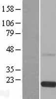RS1 / Retinoschisin 1 Protein (Over-Expression Lysate Myc-DDK (Flag))