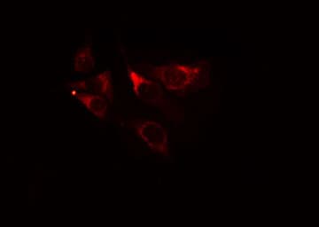 Polyclonal Rabbit anti-Human TAOK1 / TAO1 Antibody (IHC, IF, WB)