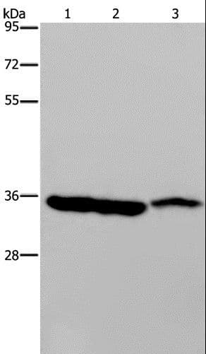 Polyclonal Rabbit anti-Human MDH1 Antibody (WB)