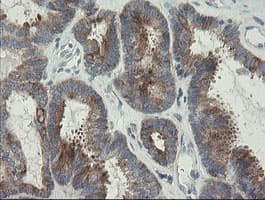 RIOK2 Antibody (aa277-552, clone OTI5D11, Carrier-free)