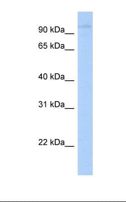LRRC8A / LRRC8 Antibody (N-Terminus, HRP)