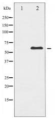 Polyclonal Rabbit anti-Human XIAP Antibody (IHC, WB)