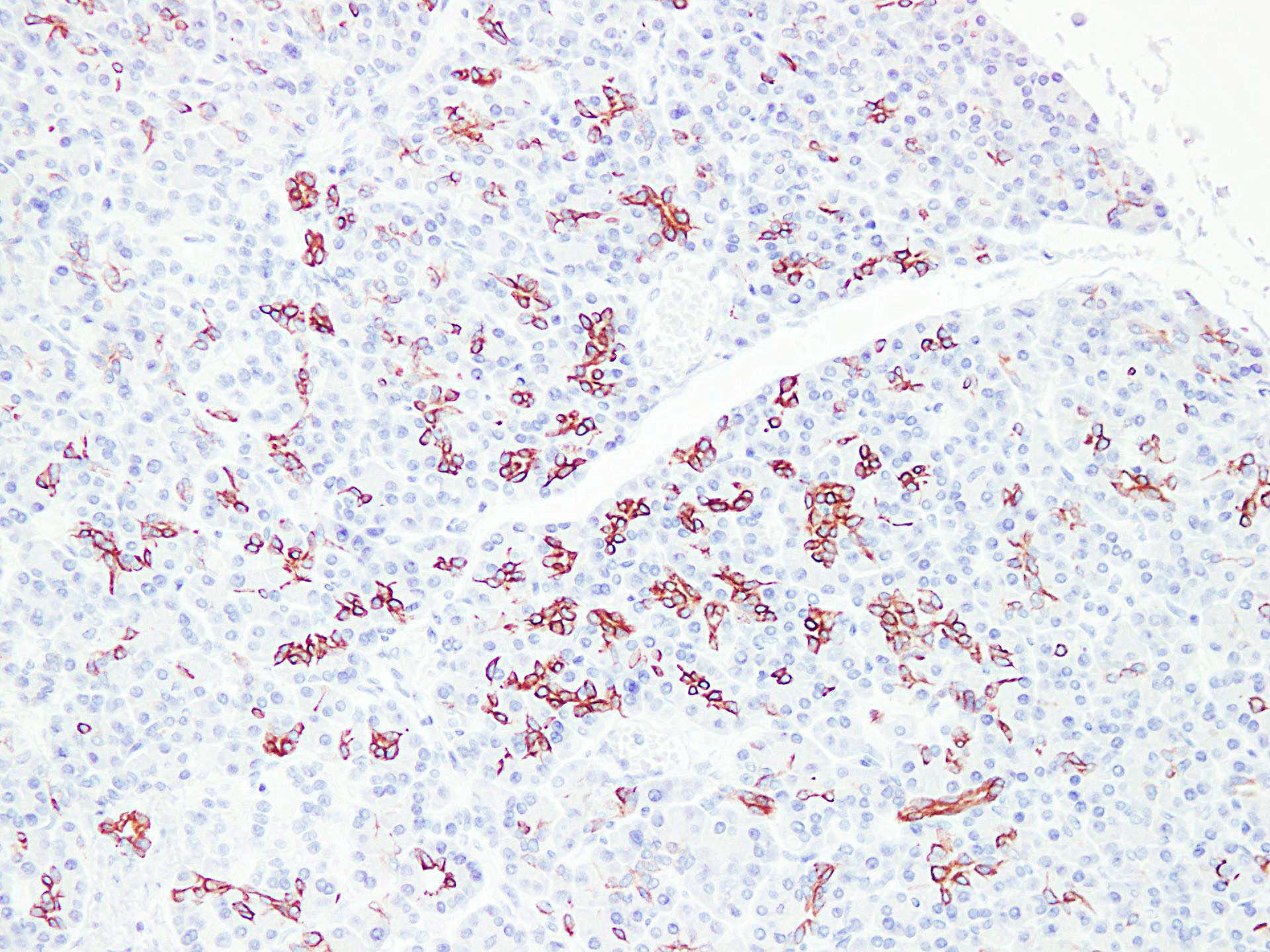 IHC-plus™ Monoclonal Mouse anti-Human KRT7 / CK7 / Cytokeratin 7 Antibody (clone ABT-CK7, IHC, WB)