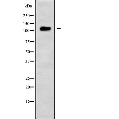 TSHZ3 Antibody