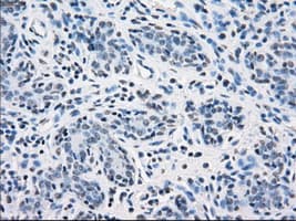 SORD / Sorbitol Dehydrogenase Antibody (clone OTI12A7)