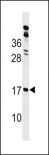 Polyclonal Rabbit anti-Human GLIPR2 Antibody (aa1-30, WB)