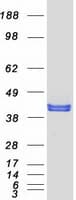 Human NUDT9 Protein (Recombinant Myc-DDK (Flag))