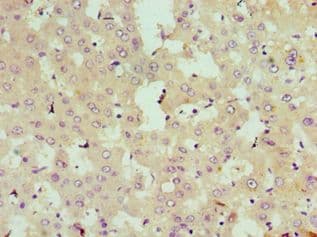 STK3 Antibody (aa323-450)