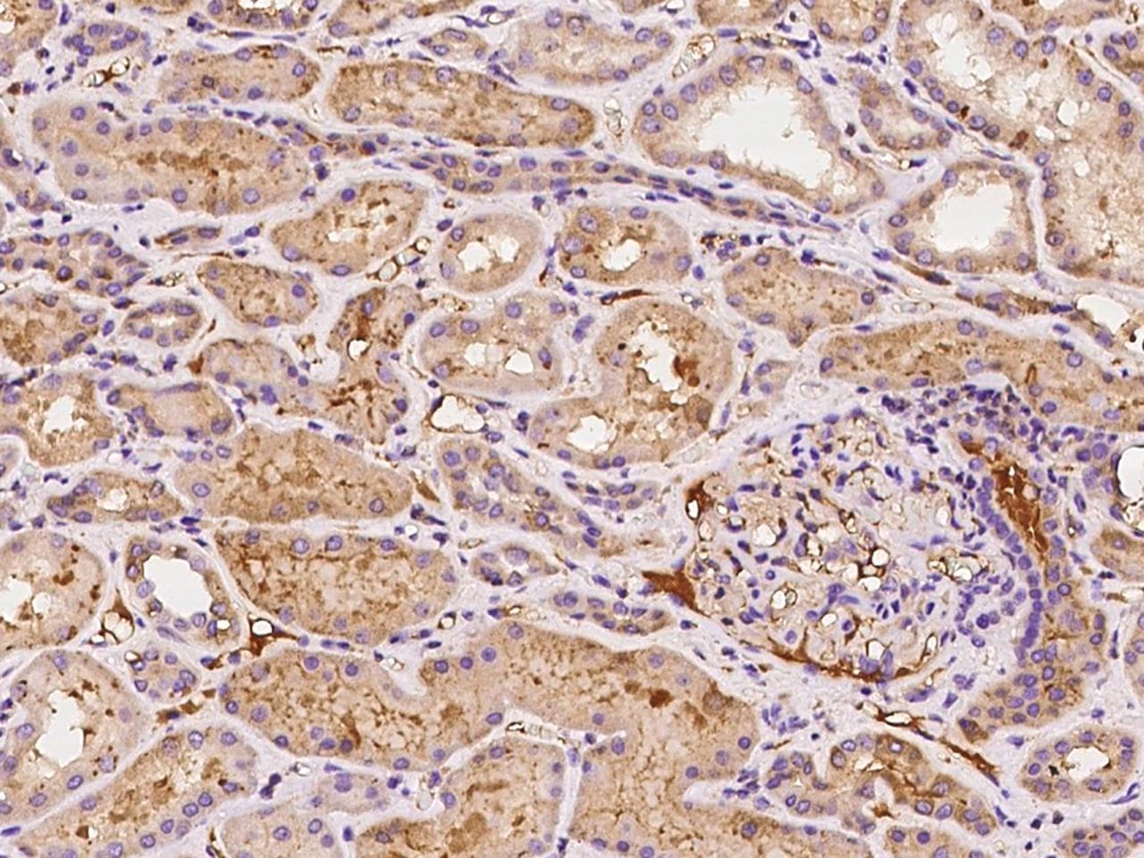 Antithrombin-III Antibody