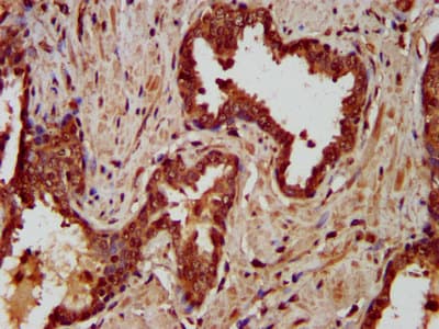 LIPH / Lipase Member H Antibody