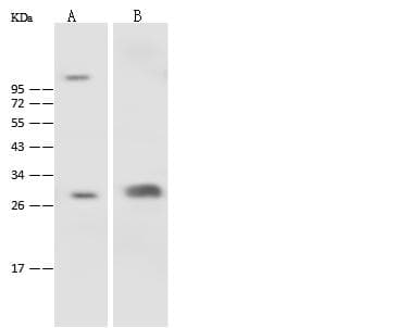 CA3 / Carbonic Anhydrase III Antibody