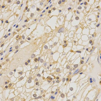 Polyclonal Rabbit anti-Human CLDN11 / Claudin 11 Antibody (IHC, IF, WB)