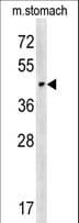 CHST14 Antibody (aa178-205)