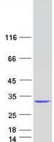 Human NUDT21 Protein (Recombinant Myc-DDK (Flag))