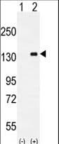 CSF1R / CD115 / FMS Antibody