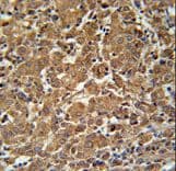 N4BP3 Antibody (aa50-79)