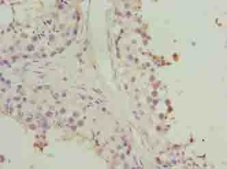 HORMAD2 Antibody