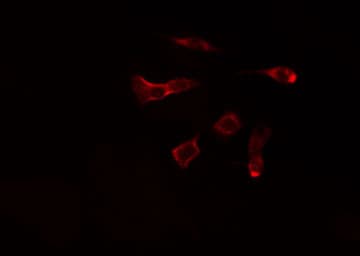 NT5C1A / CN1A Antibody