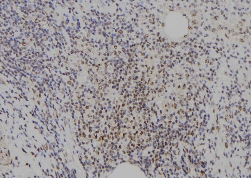 E2F8 Antibody