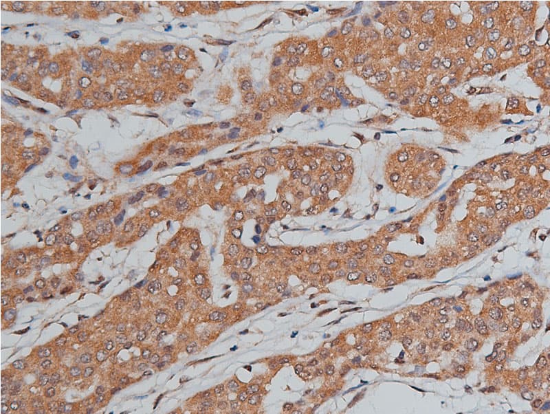 BMP3 Antibody