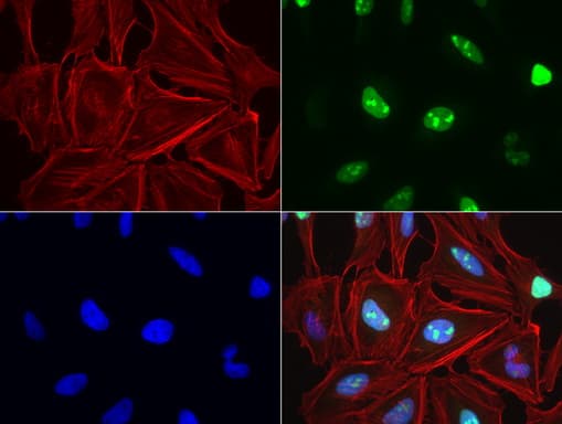 Monoclonal Mouse anti-Human TOP2A / Topoisomerase II Alpha Antibody (clone UMAB145, aa1100-1531, IHC, IF, WB)