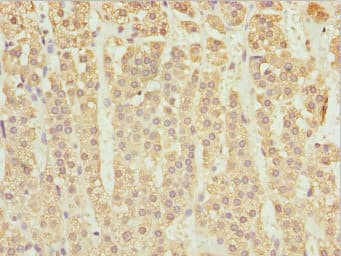 ZBTB20 Antibody