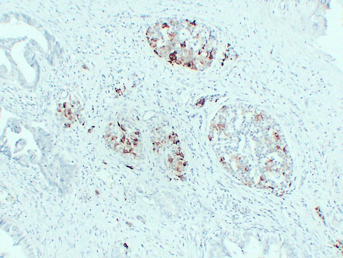 IGF2 Antibody (clone ABT-IGF2)