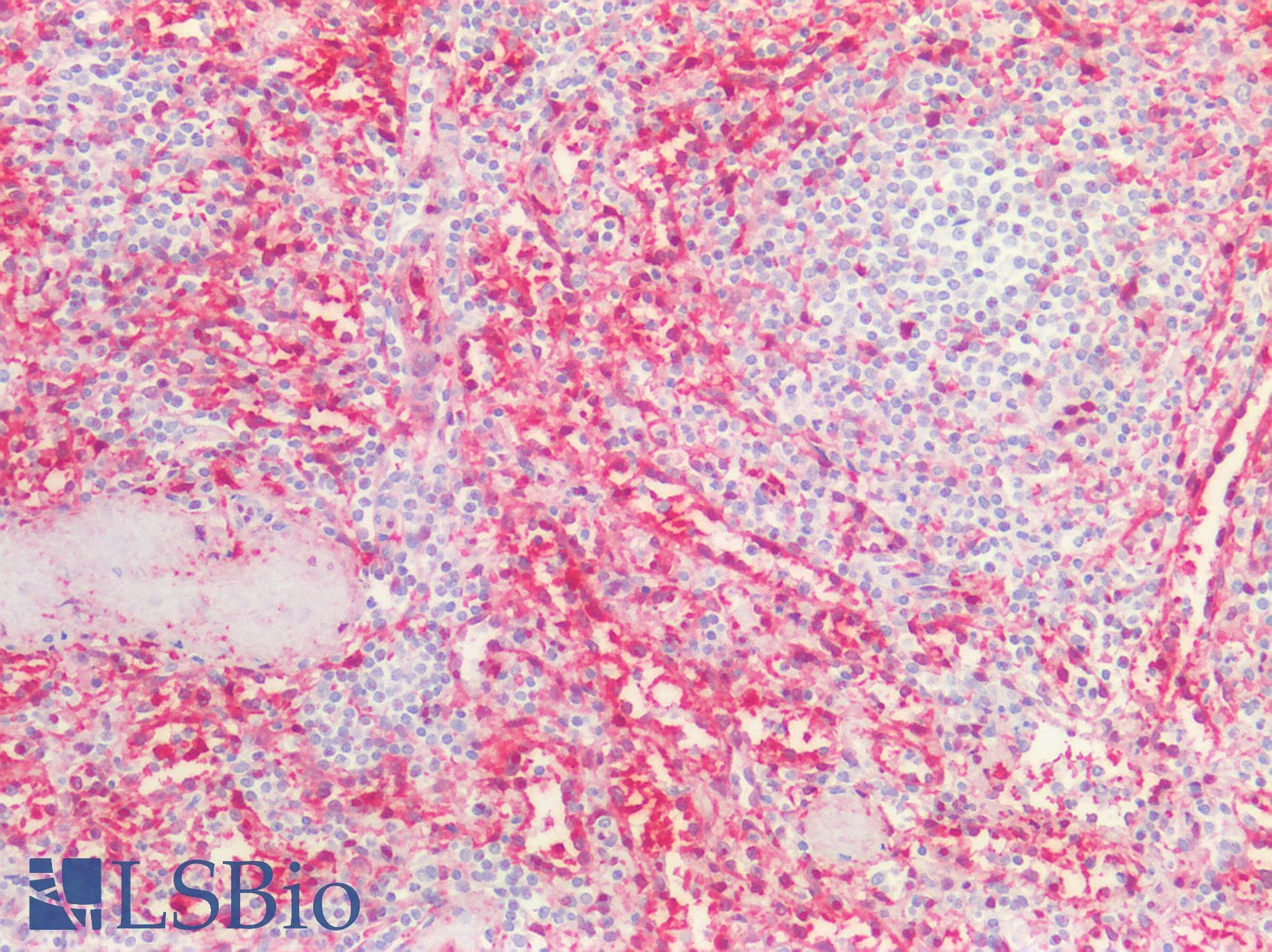 PathPlus™ Monoclonal Mouse anti-Human ALDH1A1 / ALDH1 Antibody (clone 5A11, IHC, WB)
