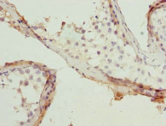 RAB5B Antibody