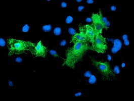 SCHIP1 Antibody (clone OTI2E7)