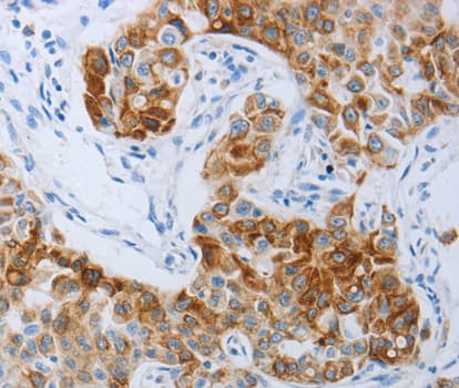 Polyclonal Rabbit anti-Human P2RY4 / P2Y4 Antibody (IHC, WB)